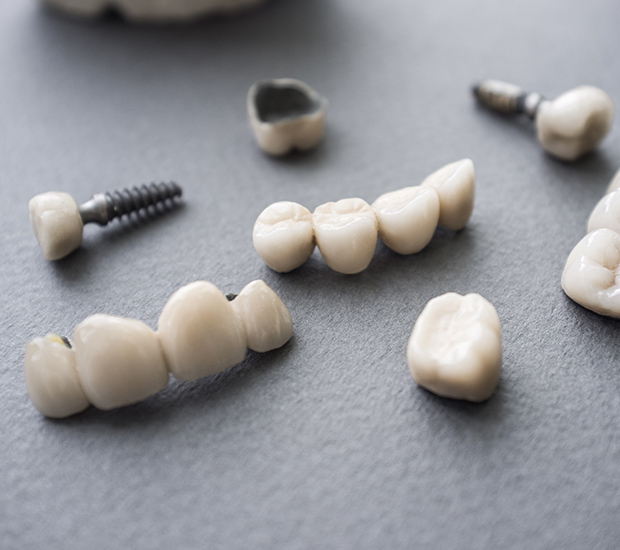 Denver The Difference Between Dental Implants and Mini Dental Implants