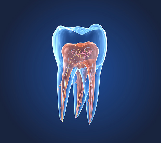 Denver What is an Endodontist